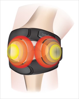 knee illustration